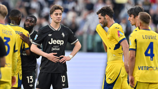 Juve: problemi muscolari per Yildiz: derby a rischio