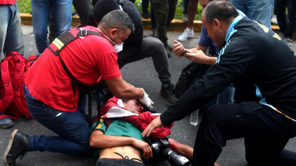 Argentine: un journaliste dans un &eacute;tat critique au lendemain d'une manifestation de retrait&eacute;s