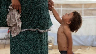 'All these rashes': chickenpox surges in Gaza camps