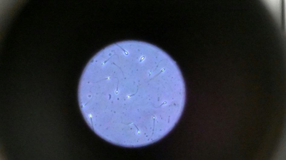 Dans l'espace, les spermatozo&iuml;des ont du mal &agrave; trouver leur chemin