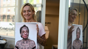 More than skin deep: Dutch abuse victims erase forced tattoos