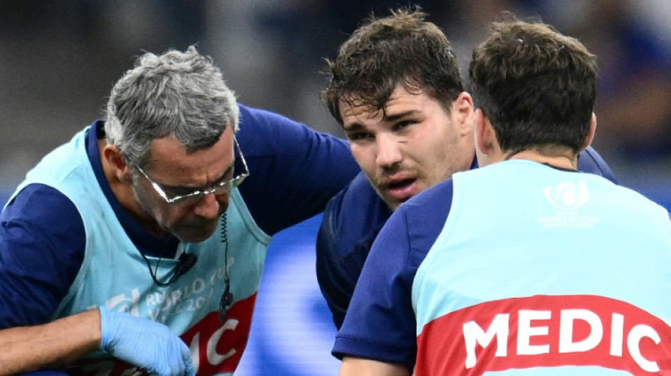 XV de France: Dupont souffre d'une fracture au niveau de la m&acirc;choire mais reste dans le groupe 