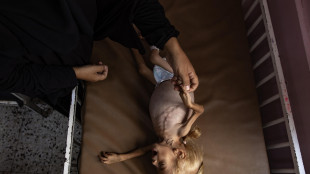 Hamas, 10 morti per malnutrizione in 24 ore tra cui 3 bambini