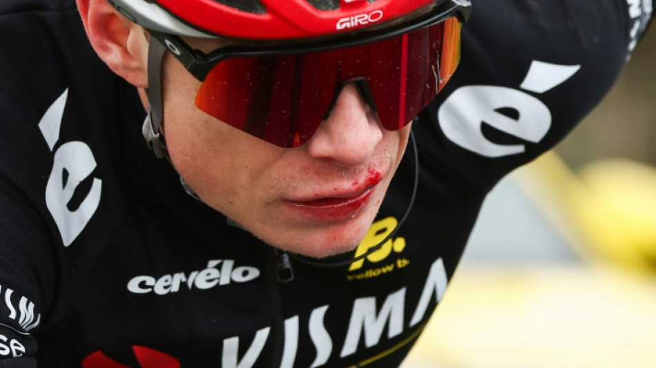 Paris-Nice: Vingegaard chute et repart avec la l&egrave;vre en sang

